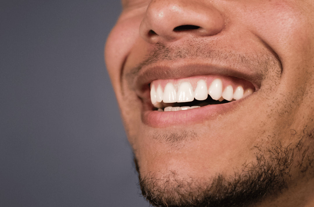 National-Gum-Care-Month-How-Can-You-Keep-Your-Gums-Healthy_resized.webp